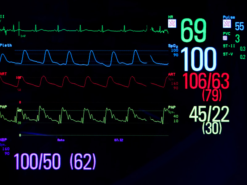ekg tetno puls saturacja kredos