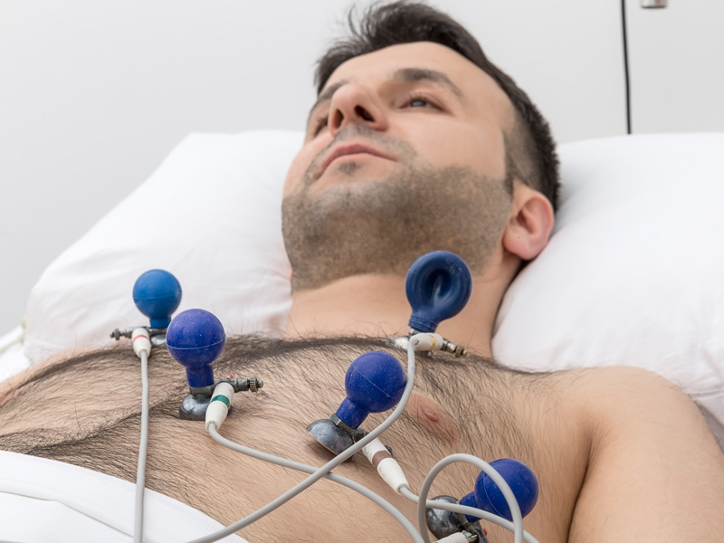 elektrokardiogram test serca kredos
