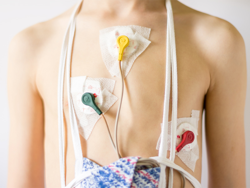 mezczyzna podlaczony elektrodami do holtera ekg
