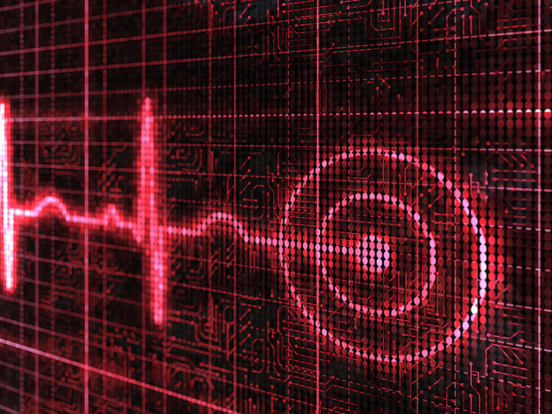 monitor ekg