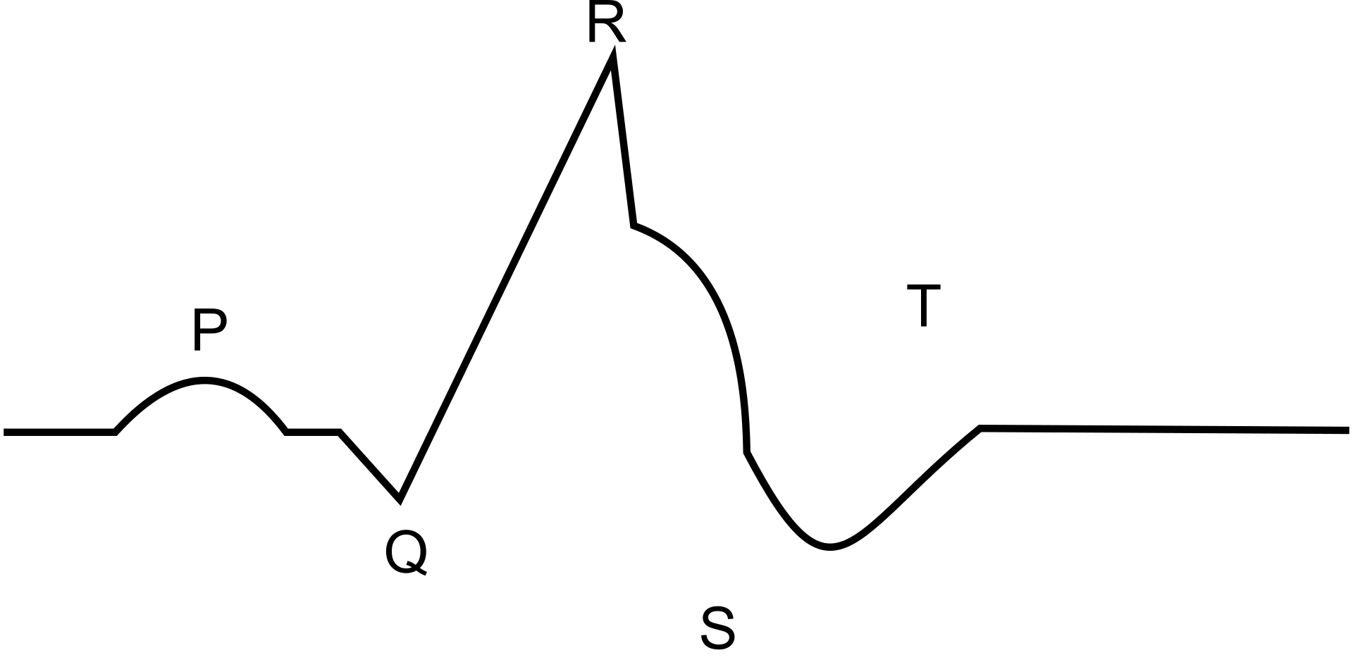 1920px EKG diagram 3
