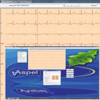 cardioteka,oprogramowanie ekg,v.001,